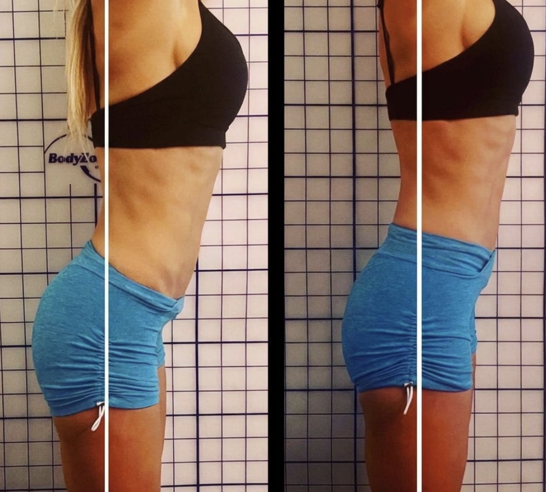 Postural Alignment — Female Side Profile