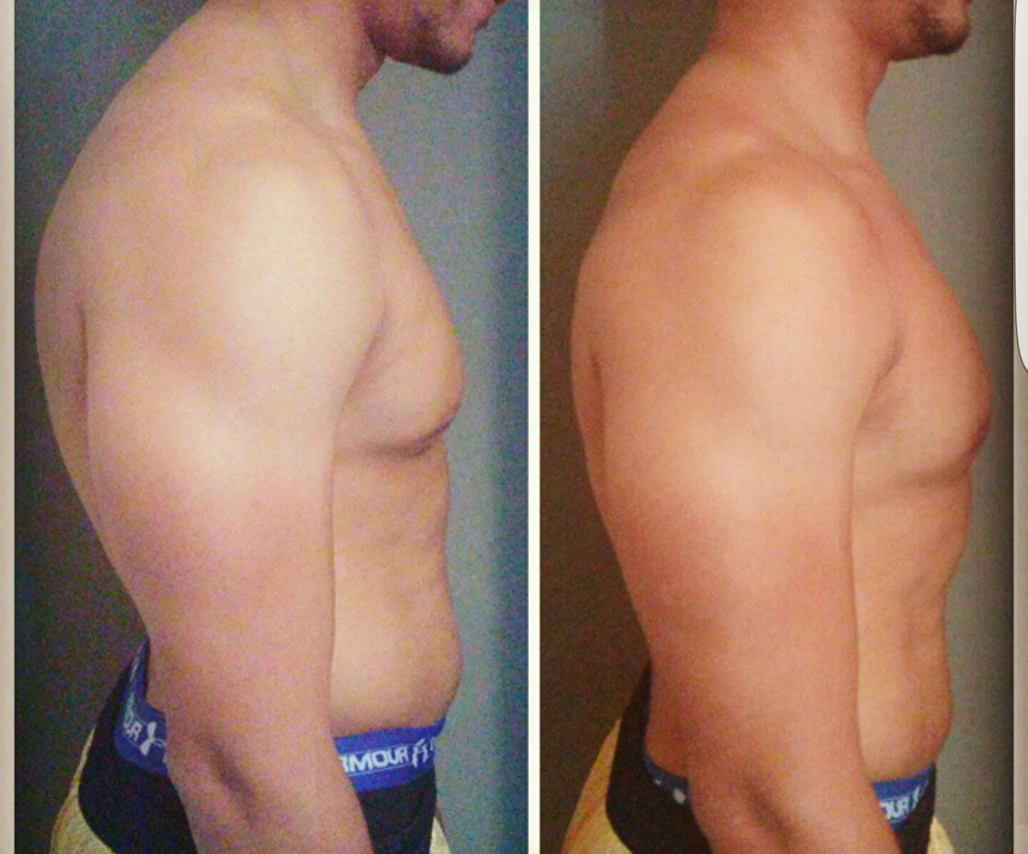 Postural Correction — Side Profile