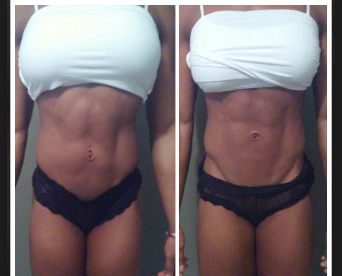 Abdominal & Core Alignment